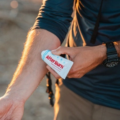 AfterBurn Gel - 2oz